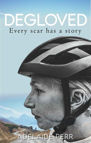 Full Cycle/Tune Up Degloved : Every Scar has a Story by Adelaide Perr
